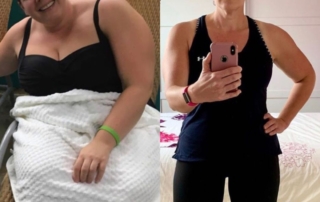 Sarah Before and after