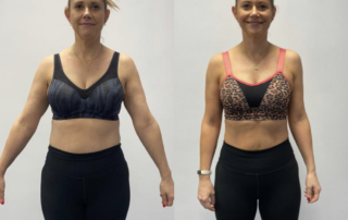 Front shape off picture