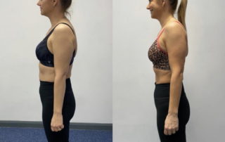 Marisa before and after side view